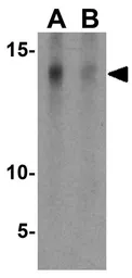 Anti-ECG2 antibody used in Western Blot (WB). GTX31458