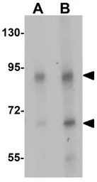 Anti-TGM5 antibody used in Western Blot (WB). GTX31459