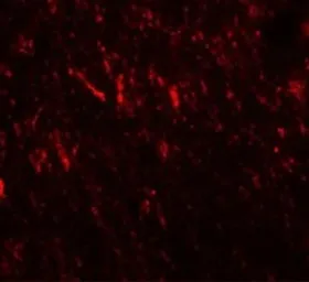 Anti-Prickle2 antibody used in IHC (Paraffin sections) (IHC-P). GTX31463