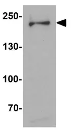 Anti-Dispatched A antibody used in Western Blot (WB). GTX31465