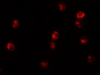 Anti-JMJD3 antibody used in Immunocytochemistry/ Immunofluorescence (ICC/IF). GTX31466