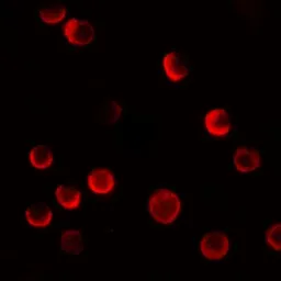 Anti-CASKIN2 antibody used in Immunocytochemistry/ Immunofluorescence (ICC/IF). GTX31467