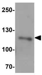 Anti-CASKIN2 antibody used in Western Blot (WB). GTX31467
