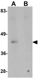 Anti-Nkx2.2 antibody used in Western Blot (WB). GTX31470