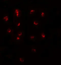 Anti-TSHZ1 antibody used in Immunocytochemistry/ Immunofluorescence (ICC/IF). GTX31472