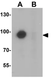 Anti-TSHZ1 antibody used in Western Blot (WB). GTX31472