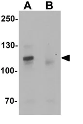 Anti-ZNF537 antibody used in Western Blot (WB). GTX31474