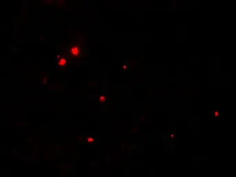 Anti-Ribonuclease T2 antibody used in Immunocytochemistry/ Immunofluorescence (ICC/IF). GTX31475