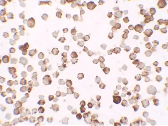 Anti-Ribonuclease T2 antibody used in Immunocytochemistry/ Immunofluorescence (ICC/IF). GTX31475