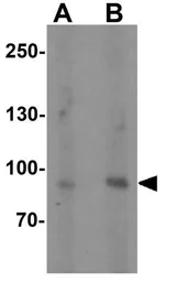 Anti-FCHO2 antibody used in Western Blot (WB). GTX31483
