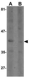 Anti-SEPT1 antibody used in Western Blot (WB). GTX31484