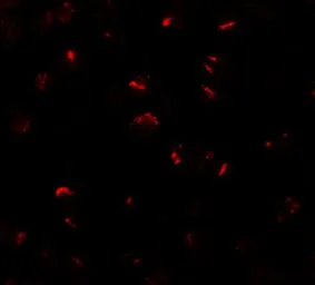 Anti-BMP15 antibody used in Immunocytochemistry/ Immunofluorescence (ICC/IF). GTX31485