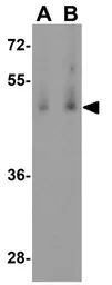 Anti-BMP15 antibody used in Western Blot (WB). GTX31485
