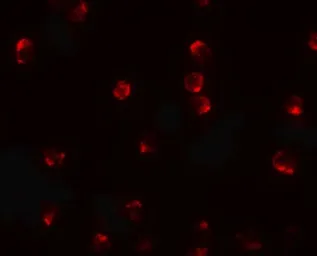 Anti-TCTEX1D2 antibody used in Immunocytochemistry/ Immunofluorescence (ICC/IF). GTX31489