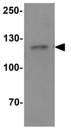 Anti-CRIM1 antibody used in Western Blot (WB). GTX31490