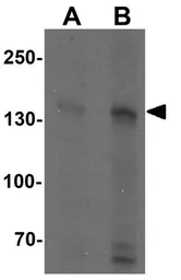 Anti-RGS22 antibody used in Western Blot (WB). GTX31492
