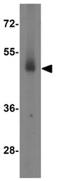 Anti-EED antibody used in Western Blot (WB). GTX31494