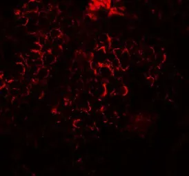 Anti-DCP2 antibody used in IHC (Paraffin sections) (IHC-P). GTX31499