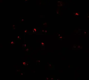 Anti-CITED2 antibody used in Immunocytochemistry/ Immunofluorescence (ICC/IF). GTX31503