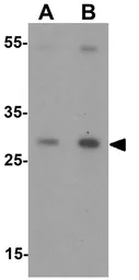 Anti-CITED2 antibody used in Western Blot (WB). GTX31503