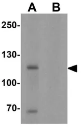 Anti-MYT1L antibody used in Western Blot (WB). GTX31505