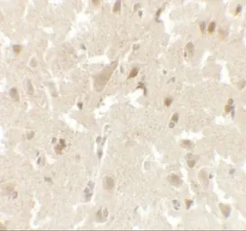 Anti-LMX1B antibody used in IHC (Paraffin sections) (IHC-P). GTX31508