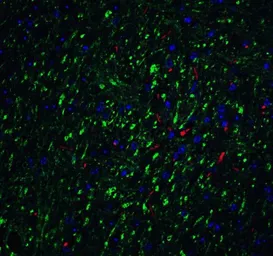 Anti-LMX1B antibody used in IHC (Paraffin sections) (IHC-P). GTX31508