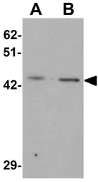 Anti-LMX1B antibody used in Western Blot (WB). GTX31508