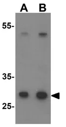 Anti-Neurogenin 2 antibody used in Western Blot (WB). GTX31509