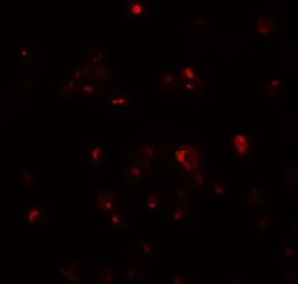Anti-Cripto antibody used in Immunocytochemistry/ Immunofluorescence (ICC/IF). GTX31511