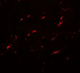 Anti-FMNL1 antibody used in Immunocytochemistry/ Immunofluorescence (ICC/IF). GTX31512