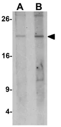 Anti-TREM1 antibody used in Western Blot (WB). GTX31516