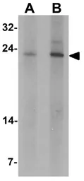 Anti-TCTP antibody used in Western Blot (WB). GTX31519