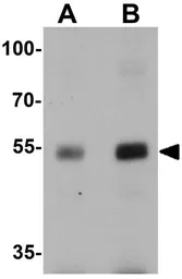 Anti-NUCB2 antibody used in Western Blot (WB). GTX31531