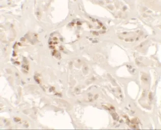 Anti-KANK2 antibody used in IHC (Paraffin sections) (IHC-P). GTX31536