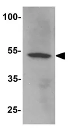 Anti-TIP60 antibody used in Western Blot (WB). GTX31538