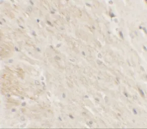 Anti-DDX41 antibody used in IHC (Paraffin sections) (IHC-P). GTX31539