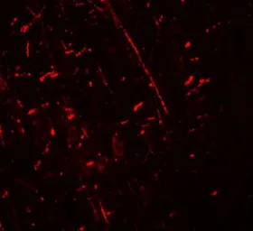 Anti-DDX41 antibody used in IHC (Paraffin sections) (IHC-P). GTX31539