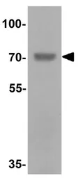 Anti-DDX41 antibody used in Western Blot (WB). GTX31539