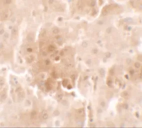 Anti-RNF20 antibody used in IHC (Paraffin sections) (IHC-P). GTX31540
