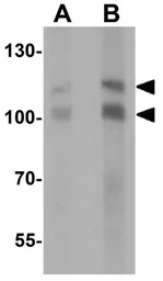 Anti-RNF20 antibody used in Western Blot (WB). GTX31540
