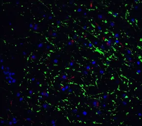 Anti-GABARAP antibody used in IHC (Paraffin sections) (IHC-P). GTX31541