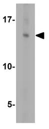 Anti-GABARAP antibody used in Western Blot (WB). GTX31541