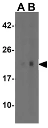 Anti-N-RAS antibody used in Western Blot (WB). GTX31543