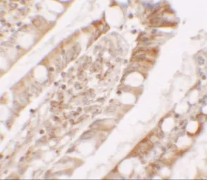 Anti-Lipin 1 antibody used in IHC (Paraffin sections) (IHC-P). GTX31547