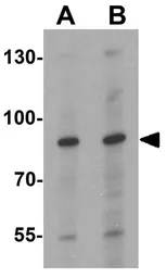 Anti-CBP80 antibody used in Western Blot (WB). GTX31548