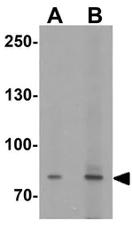 Anti-CD66e antibody used in Western Blot (WB). GTX31551