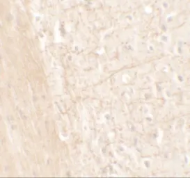Anti-ERAP1 antibody used in IHC (Paraffin sections) (IHC-P). GTX31553