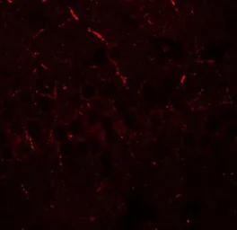 Anti-ERAP1 antibody used in IHC (Paraffin sections) (IHC-P). GTX31553