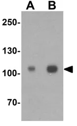 Anti-ERAP1 antibody used in Western Blot (WB). GTX31553
